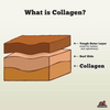 RedBarn Collagen Braided Ring